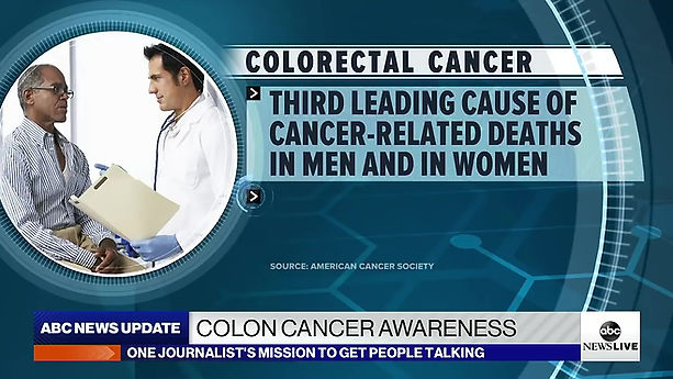 Doctors warn of spike in colon cancer rates among young adults